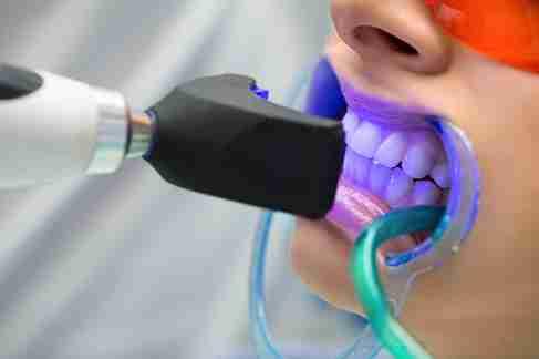 Image Source - Emergency Dentist Newport