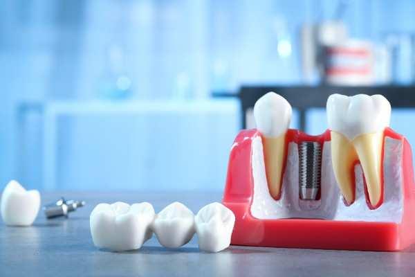 emergency dentist in Shrewsbury