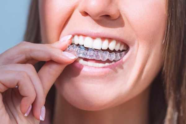 orthodontist Lowestoft
